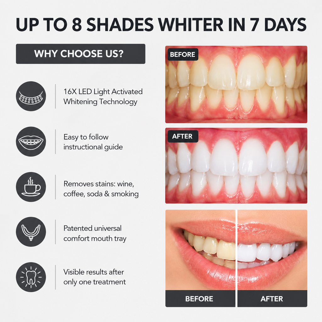 LED Teeth Whitening Kit – Home Whitening System with Tray & Light